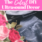 ultrasound picture with text overlay - the cutest diy ultrasound decor