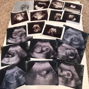Cute Ideas For Baby Sonogram Pictures – LujaStyles
