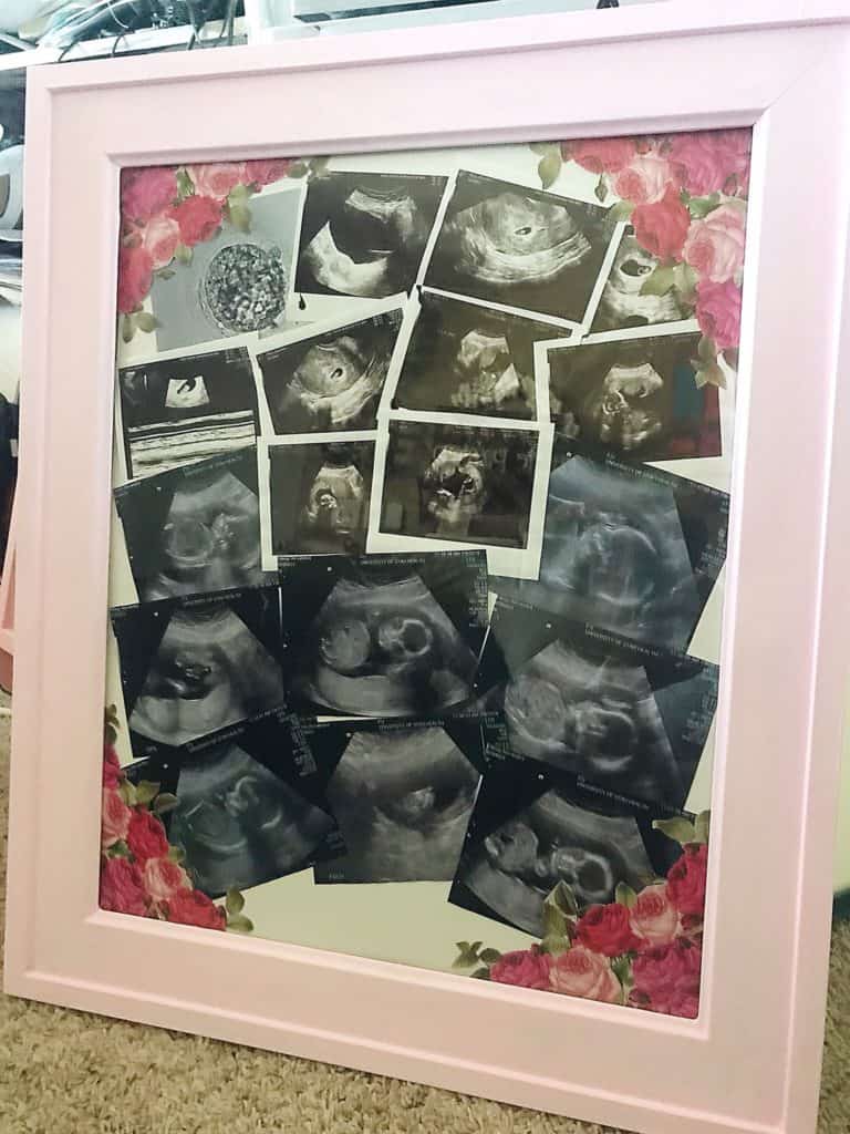 The Perfect Idea For Ultrasound Pictures and Nursery Decor